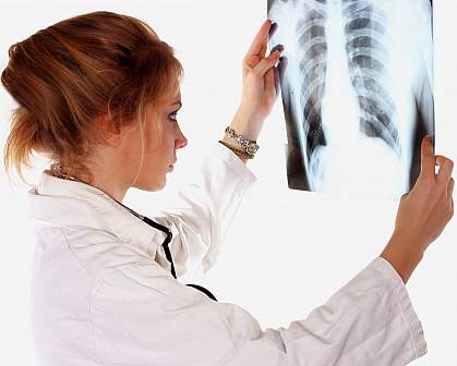 Photo of a female doctor looking at a lung x-ray