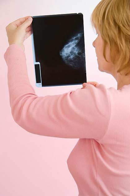Photo of a woman looking at a mammogram X-ray