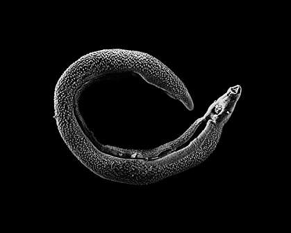 Microscopic worm curled into C shape