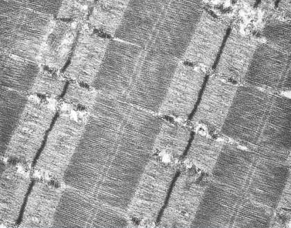 Microscopic field showing several sarcomeres, each with a heavy black line at either end. Sets of lighter parallel filaments extend about a quarter of the way toward the centers. The filaments filling the middle half are darker