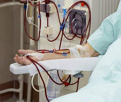 Photo of two patients on dialysis