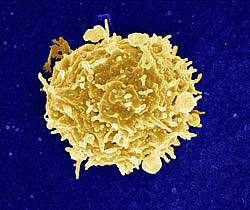Scanning electron micrograph of a T Cell