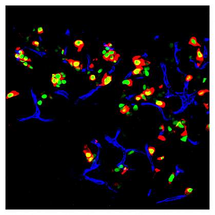 Microscope image of multicolored cells in a mouse pancreas