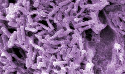 Electron micrograph showing cluster of many bacteria