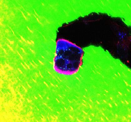 Photo of a microscope image of cell tunneling through bone matrix, leaving a black trail