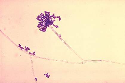 Microscope image of a fungus