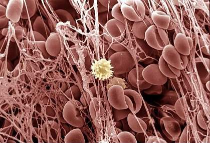 Image of red and white blood cells