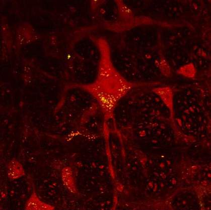 Image of yellow dots in red brain cell