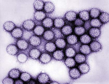 Cluster of round rotavirus particles