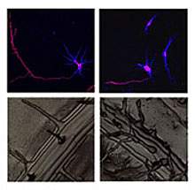 Image panel shows that atlastin/RHD3 deficiency causes shortening of rat neurons and short, wavy root hairs in a plant