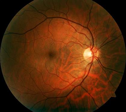 Photo of human retina