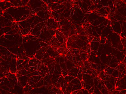 Image of red-labelled neurons