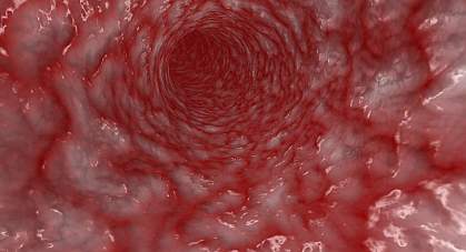 Image of the interior of an artery