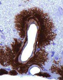 Microscopic image of dark staining surrounding an open space