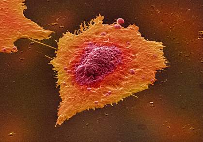 Image of a human colon cancer cell