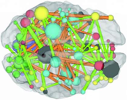 Schematic of a brain showing colorful connections within