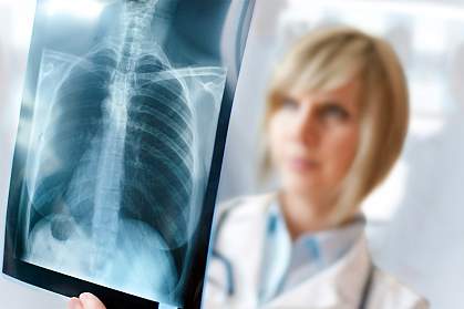 Photo of a doctor viewing a chest x-ray