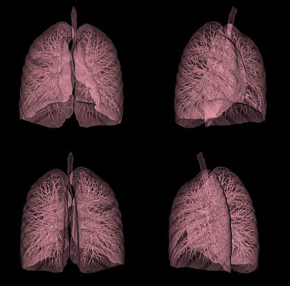 CT scan of a human lung