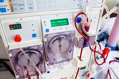 Photo of dialysis equipment