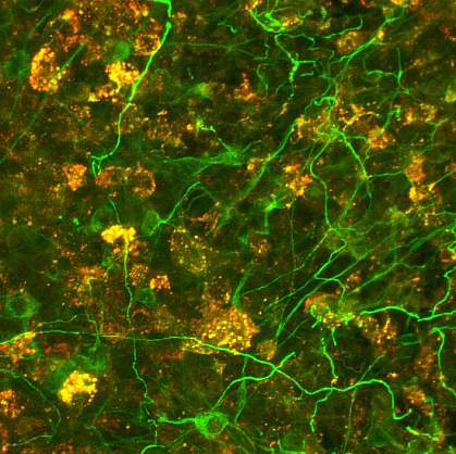 Microscope image showing clusters of red dots scattered among a field of green neurons