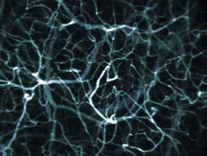 Microscope image of a blood vessel network