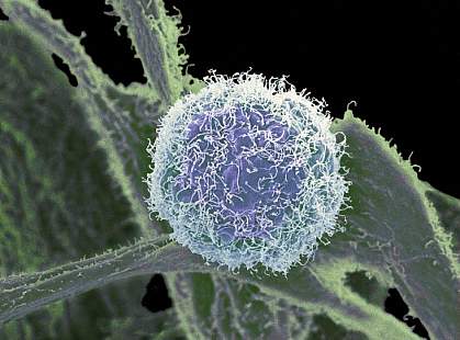 Electron micrograph of a round cell with stringy filaments on its surface