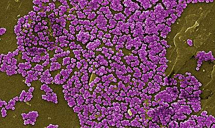 Scanning electron microscope image showing lumps of purple spherical bacteria