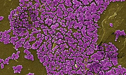 Scanning electron microscope image showing lumps of purple spherical bacteria