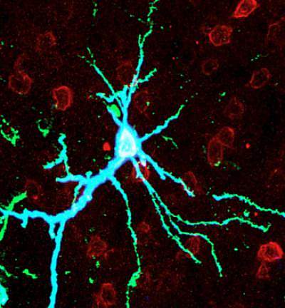 Microscope image of intense blue neuron.