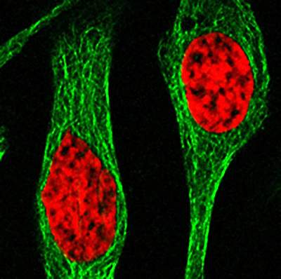 Microscope image of red circular areas in 2 cells 