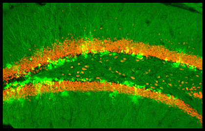 Microscope image shows bright green splotches near thick orange lines.