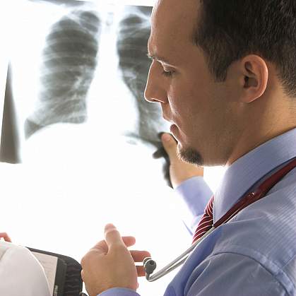 Photo of doctors looking at an x-ray cropped