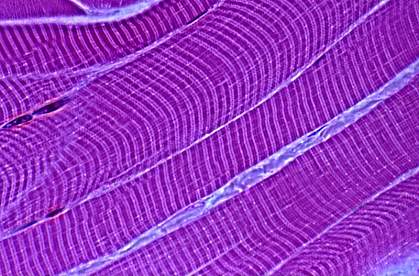 Microscopic image of striped muscle fibers.