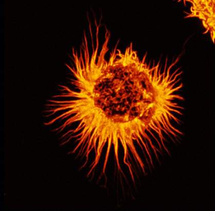  Micrograph of a round cell with many long and slender protrusions