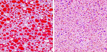 Right panel shows photo of fat tissue with large, bright red droplets; left panel shows fat tissue with small, scattered droplets.