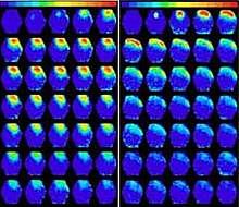 Photo of numerous images of mouse brains, with more on the left showing yellow and red areas.