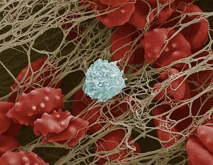 Scanning electron micrograph of blood cells trapped in a fibrous mesh