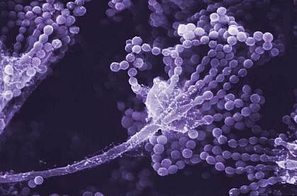 Scanning electron micrograph showing a long stalk with multiple beaded strands at the tip.