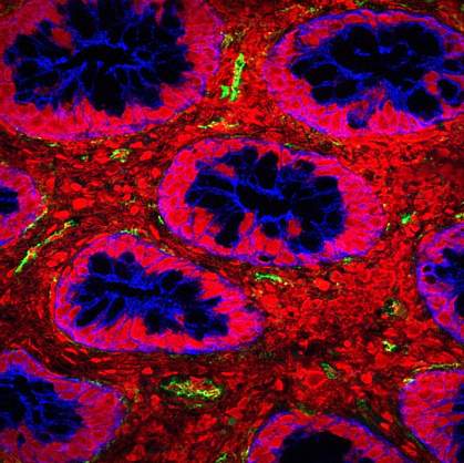 Confocal micrograph shows scattered green areas in red intestinal tissue