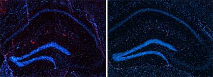 Two similar microscope images, with more red spots in the left one.