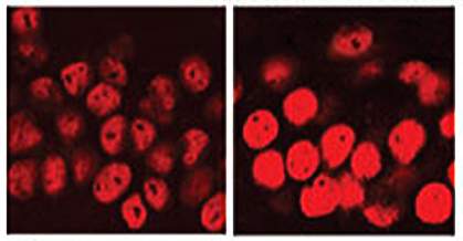  Side by side microscope images, with cells on right glowing a brighter red.