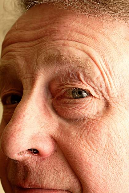 Photo of a senior man focused on the eye.