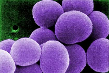 Staphylococcus bacteria.