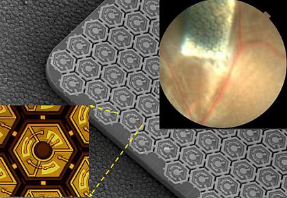 Photovoltaic chip.