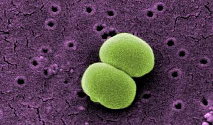 maintain ignorance Scholar Bacteria on Skin Boost Immune Cell Function | National Institutes of Health  (NIH)