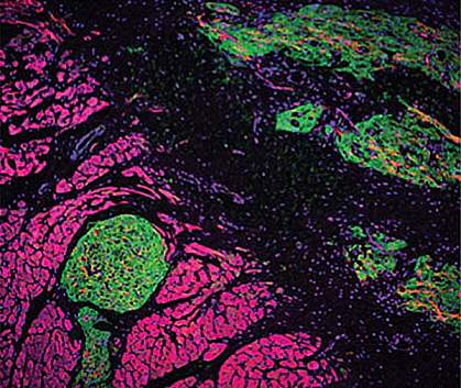 Confocal micrograph of green and pink patches of cells.