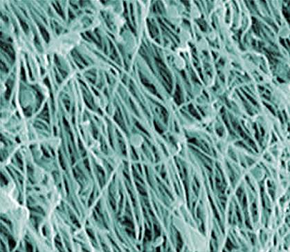 Scanning electron micrograph of cilia.