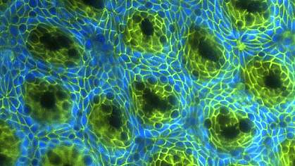 Microscope image shows intestinal lining with areas of dark green cells.