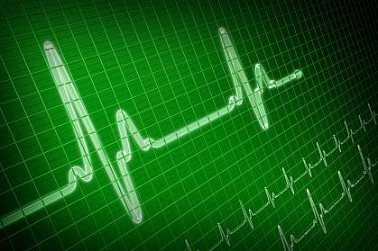 Photo of electrocardiogram showing a heart pulse.