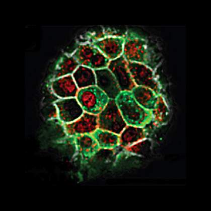 Confocal microscope image showing mass of cells with green and red areas.